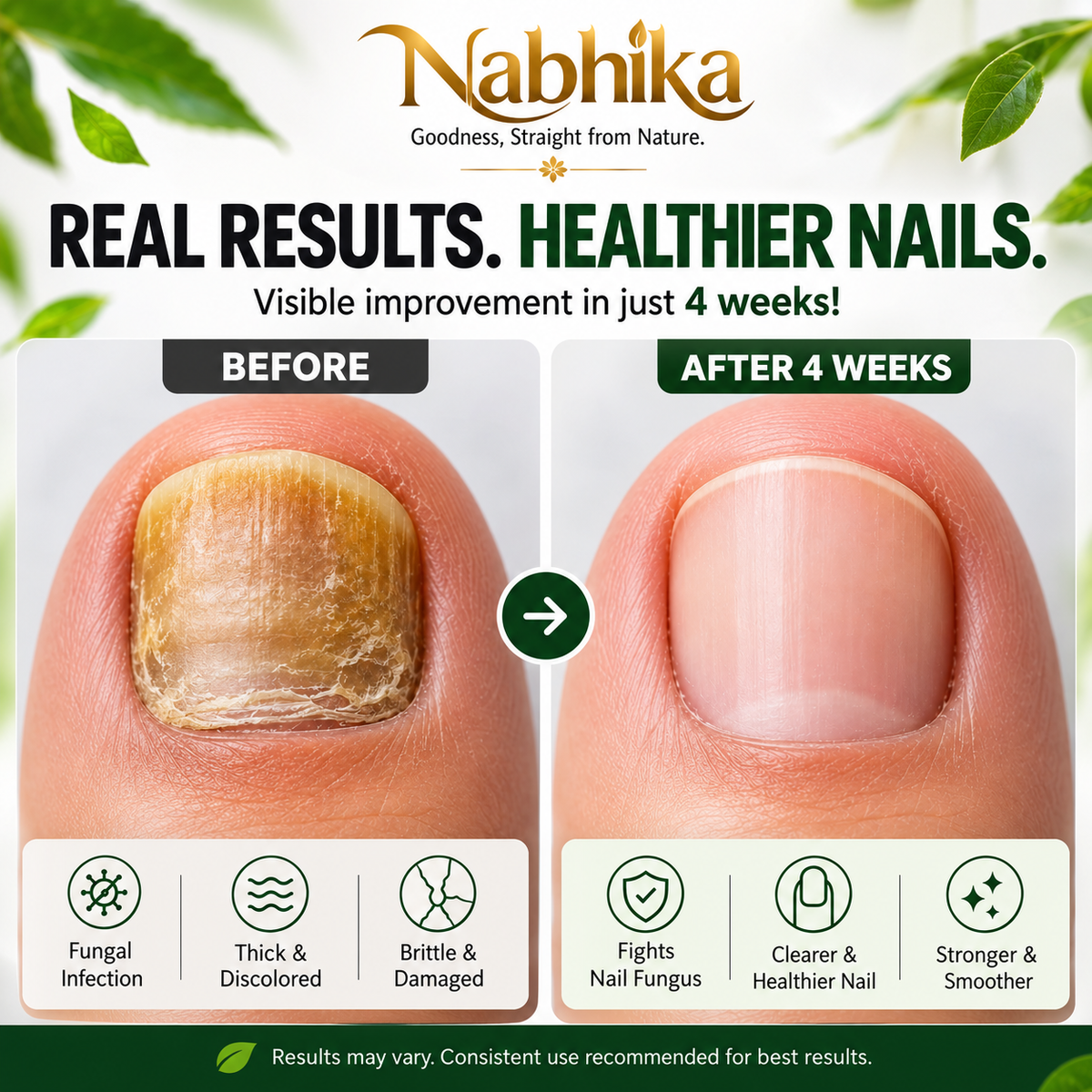 Nabhika™ Nail Repair Oil